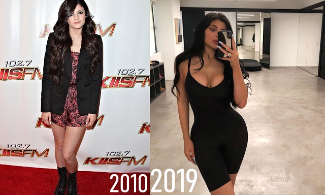 Best Plastic Surgery says Lousville Fans Kylie Jenner Changes 2010 vs 2019