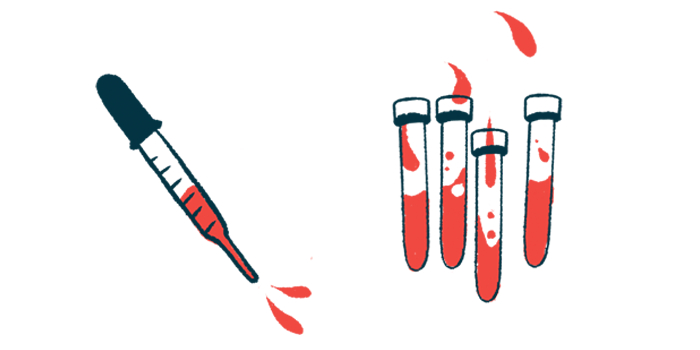 MS Patients Have A Blood Biomarker That May Indicate A Gilenya Response